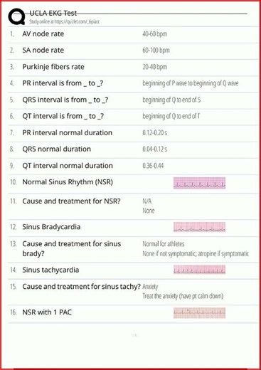 Ucla Ekg Test Updated Actual Exam With Correct Solutions1342 video
