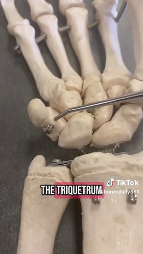 Understanding the Triquetrum Bone in Human Anatomy