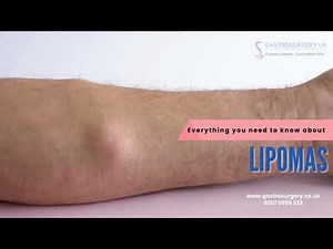 What is Lipoma - everything you need to know | Fatty lump