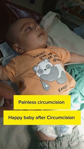 Painless circumcision in a small baby #baby #childsurgeon #circumcision #foreskin