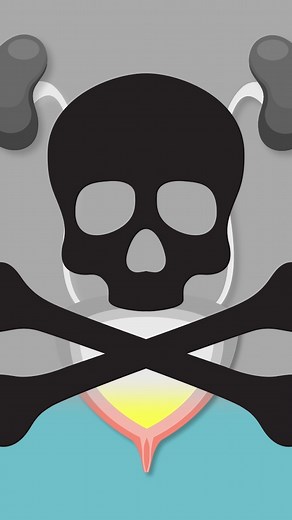 21K views · 163 reactions | Urinary retention is a condition that prevents your bladder from fully emptying when you pee. #urinaryretention #bladder #healthandwellness | Insider Science | Facebook