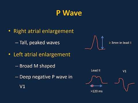Pediatric ECG Interpretations