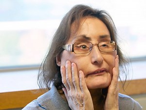 Connie Culp, First U.S. Recipient Of Face Transplant, Dies At 57