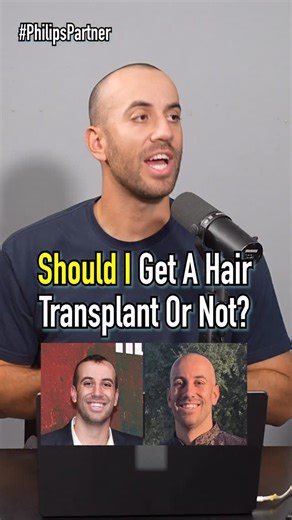 The Makeshift Project on Instagram: "#ad Zach FINALLY Decides Whether Or Not To Get A HAIR TRANSPLANT! Get your @philipsnorelco Head Shaver Pro at the link in our bio! #fyp #bald #hair #PhilipsPartner"