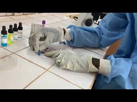 Blood grouping technique erythrocytic method