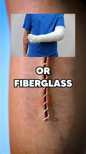 How Doctors Make Stiches 😯