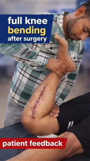 full knee bending exercises after surgery 🫨 acl recovery shorts video, ghutna jaam ki exercise