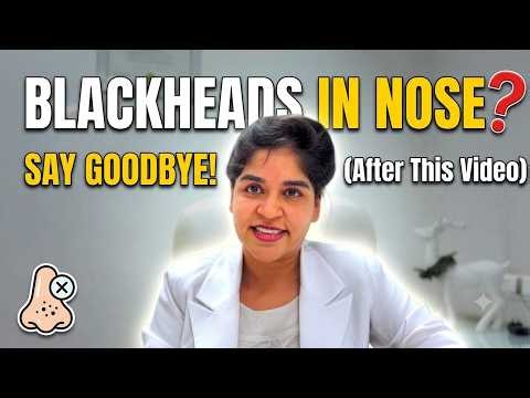 Black heads in nose - Saygoodbye after this video | blackhead removal blackheads treatment