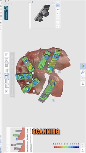 Scan Ladder on Instagram: "“Easy screw tightening does not guarantee passive fit.” Exactly this. As discussed by Ahmed Abd Alkareem Aljumili, full arch workflows often prompt deeper conversation around how small variables in scanning, seating and planning can influence downstream stages of a digital process. Passive fit is frequently explored in professional education not as a tactile impression, but as the result of how workflows are structured and aligned from the outset. Scan Ladder is often
