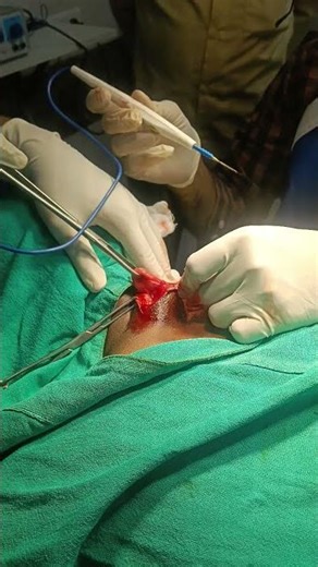 Inclusion cyst nape of neck