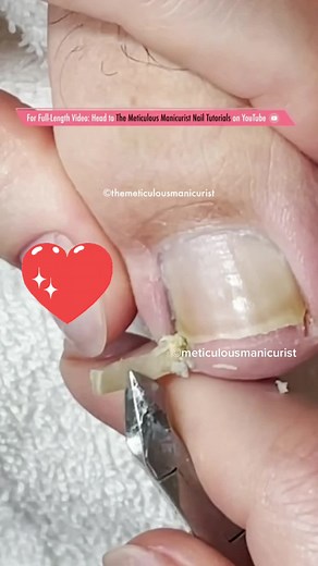 Every toenail has a story to tell and everyone has a favorite to watch! #OutlanderChallenge #pedicure #toenail #satisfying #transformation #fyp