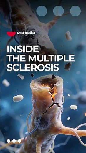 What Happens Inside Your Nerves When You Have MS #medical #science #multiplesclerosis
