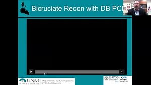Tips & Tricks for Isolated and Combined PCL Reconstructions