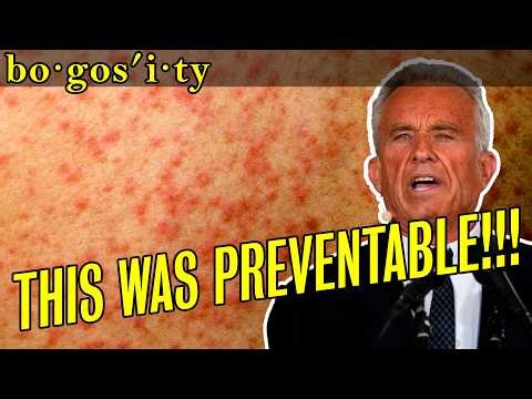 Measles is EXPLODING! 1,000 Cases and RISING!!!