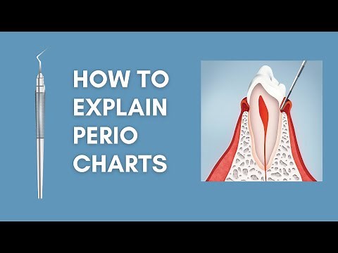 How to explain PERIO CHARTS