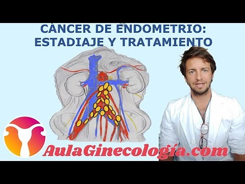 Treatment and staging of endometrial cancer: surgery, chemotherapy, and radiation - Gynecology an...