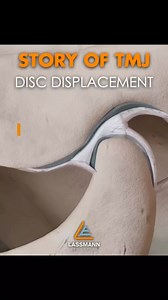 22K views · 472 reactions | Many of you suffer from TMJ issues… some...