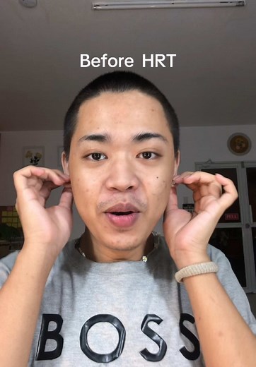 Understanding HRT: A Guide for Trans Women