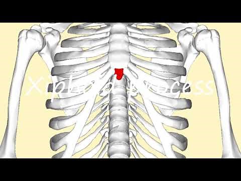 How to Pronounce Xiphoid process?
