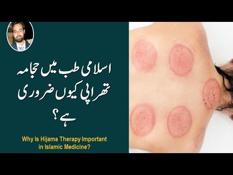 Why You Should Do Hijama? Medical & Sunnah Benefits Explained