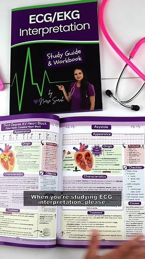 ECG EKG Interpretation Study Guide for Nursing Students