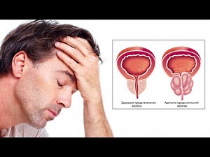 Easy Natural Fix for Prostate Health