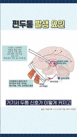 편두통은 ‘뇌’에서 시작됩니다 (시상하부) #편두통 #두통원인 #시상하부 #삼차신경 #뇌건강
