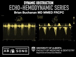 Dynamic obstruction echo dynamics
