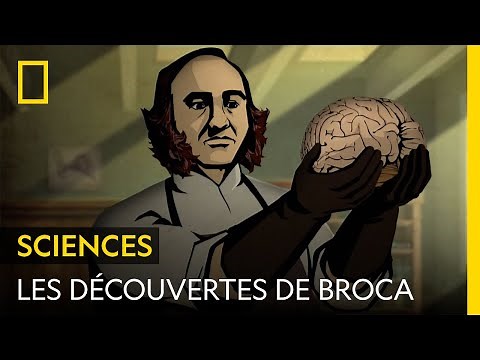 Connaissez-vous Paul Broca, le chirurgien qui a donné son nom à une partie du cerveau ?