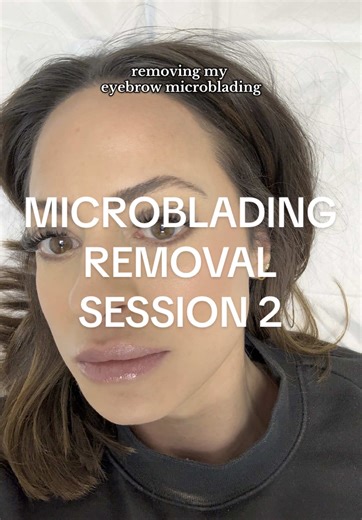 Microblading Removal Session 2: What to Expect