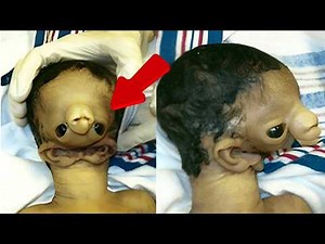 This Baby Was Born Different… Meet 12 Rare People You Won’t Believe Exist