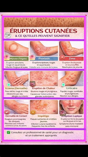 Rougeurs, squames, cloques ou papilles : chaque éruption cutanée peut révéler une cause spécifique (allergie, infection, auto-immunité…). Mieux comprendre pour mieux consulter. #ÉruptionsCutanées #Peau #Dermatologie #Santé #Diagnostic Badara Ndiaye Pierre Pierre | Eurêka Sciences