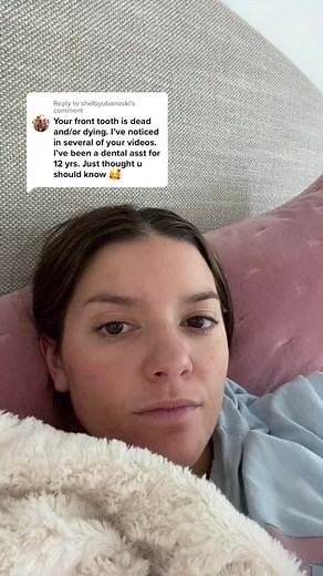 Dealing with a Dead Front Tooth: My Dental Journey