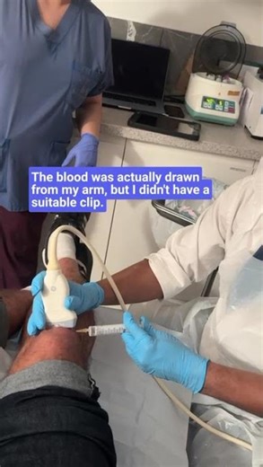 PRP Knee Injection in London: Healing Tennis Injury | Real Patient Review