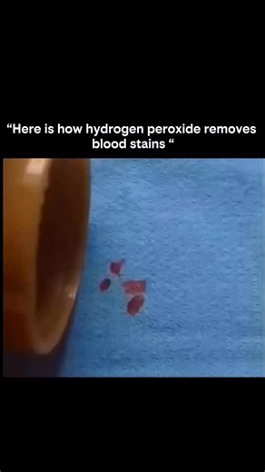 KNOWLEDGE MATRIX on Instagram: "Hydrogen peroxide doesn’t just clean blood stains — it breaks them apart. Blood contains a protein called catalase, which reacts with hydrogen peroxide and causes it to bubble. That reaction releases oxygen, which helps break down hemoglobin — the molecule that gives blood its red color. The bubbling you see isn’t magic. It’s chemistry in action. As the stain breaks down into smaller, colorless components, it becomes easier to wash away. Science turns a tough stai
