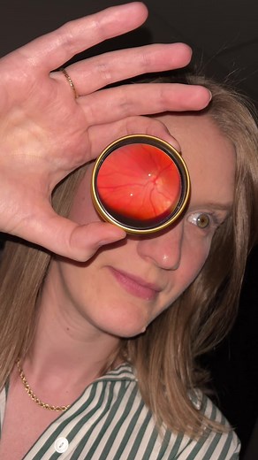 What Your Eye Doctor Sees: Up Close Look at the Retina