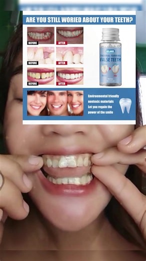 Quick Tooth Replacement with Moldable Fake Teeth