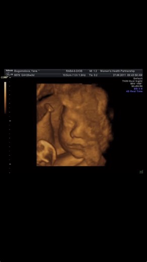 Dr. Leslie Dobson on Instagram: "This isn’t normal. Wake up. Trump is stopping the unredactions- @repnancymace said he never wanted the files out. I found this file that I don’t think anyone was supposed to see. Where are all the babies? Why isn’t this on the news? #maga #trump #justice #protectthechildren"