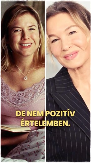 Mi történt Renée Zellweger arcával? A rajongók alig ismertek rá! 😲💉 #BridgetJones #plasztika