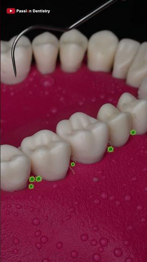 Floss Picks or Floss Strings ! Save or Damage Your Teeth