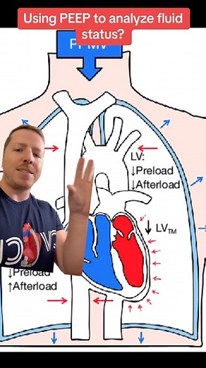 PEEP and Volume Status! . . #cvicu #cardiacnurse #criticalcare #nursingschool #icunurse #newgradnurse #newgradrn #nursesofinstagram #icunurselife #telemetry #criticalcarenurse #nursetok #nurselife #criticalcarenurse | Nurse Dose Podcast