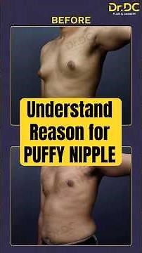 Science behind Puffy Nipples Explained! | Dr DC, Plastic Surgeon | India