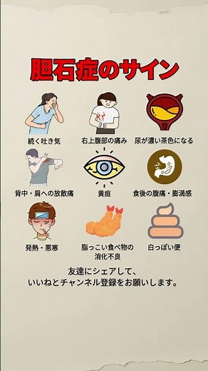 胆石症のサイン｜絶対に見逃してはいけない体の警告 #胆石症 #胆石 #右上腹部痛 #黄疸 #健康知識 #消化不良 #医療情報 #健康管理 #体のサイン #ショート動画 #ヘルスケア