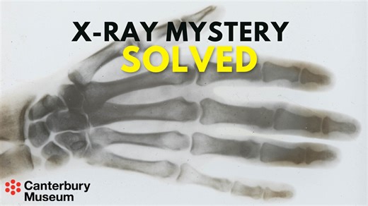 194 reactions · 23 shares | A tiny creature in the Canterbury Museum collection has helped rewrite the history of X-rays in New Zealand. Read more: www.canterburymuseum.com/explore/our-stories/a-tiny-museum-specimen-helped-solve-an-x-ray-mystery | Canterbury Museum | Facebook