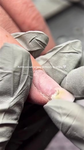 Healthy Nails: Importance of Full Removals and Refills