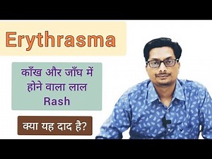 काँख और जाँघ में होने वाला लाल Rash | क्या यह दाद है? Erythrasma - Rash in groin, axilla, abdomen