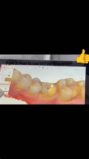 Dr. Minal Kumthekar Khandke on Instagram: "Part 3 How to use scanner ....Now streaming"