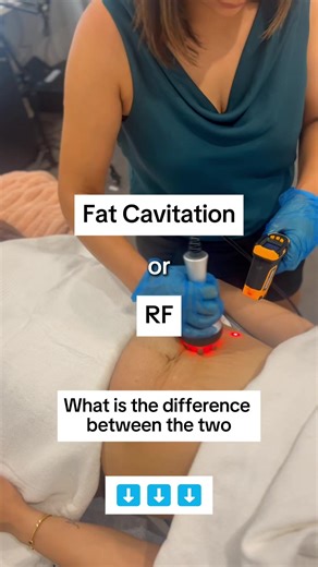 Cavitation or RF… they are NOT the same thing, and picking the wrong one is why so many people “try body contouring” and feel like nothing happened. Here is the simple breakdown 👇 Fat Cavitation = fat sculpting This is the treatment for when you can pinch stubborn fat and it just will not budge, even when you are eating better or training. Cavitation uses ultrasound waves to target fat cells in specific areas (think lower belly, love handles, thighs, arms, back and bra bulge). The goal is a sli