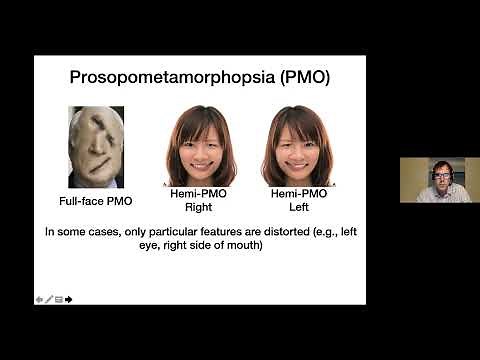 Prof Brad Duchaine on "Prosopometamorphopsia: Face distortions as a window into face representation"