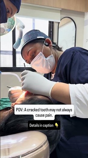 POV: A cracked tooth may not always cause pain.